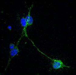 NrCAM (in green) within brain nerve cells